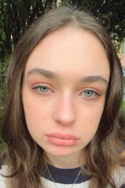 After